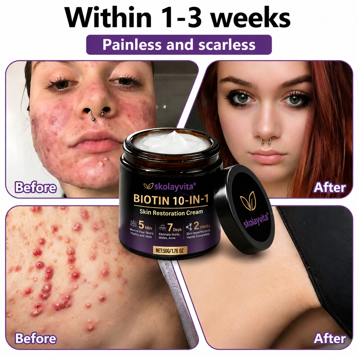 Made and Shipped from USA ✨SKOlayvita™ Biotin 10-in-1 Skin Restoration Cream 🍀