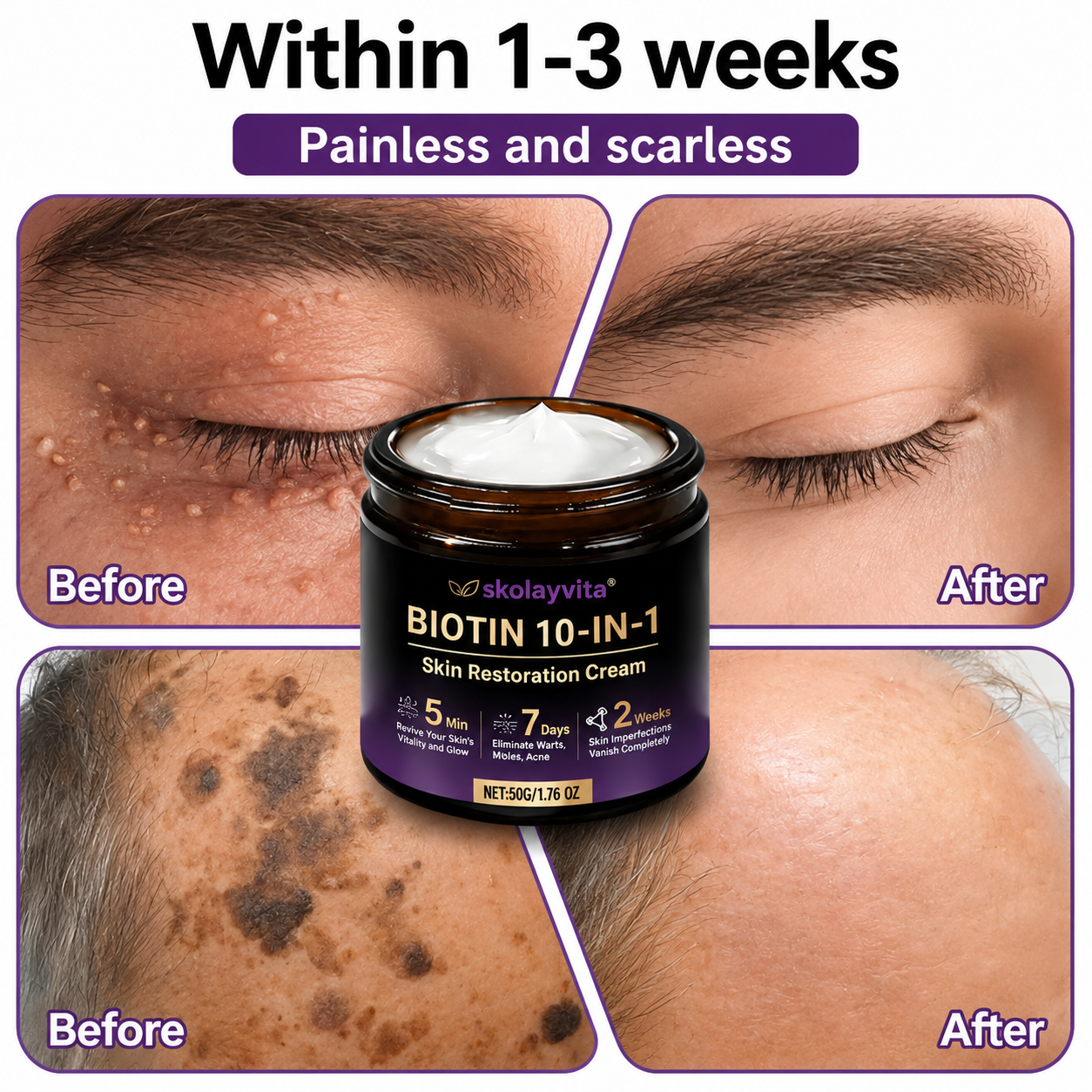 Made and Shipped from USA ✨SKOlayvita™ Biotin 10-in-1 Skin Restoration Cream 🍀